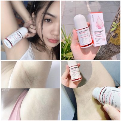 مبيض ومزيل التعرق الكوري